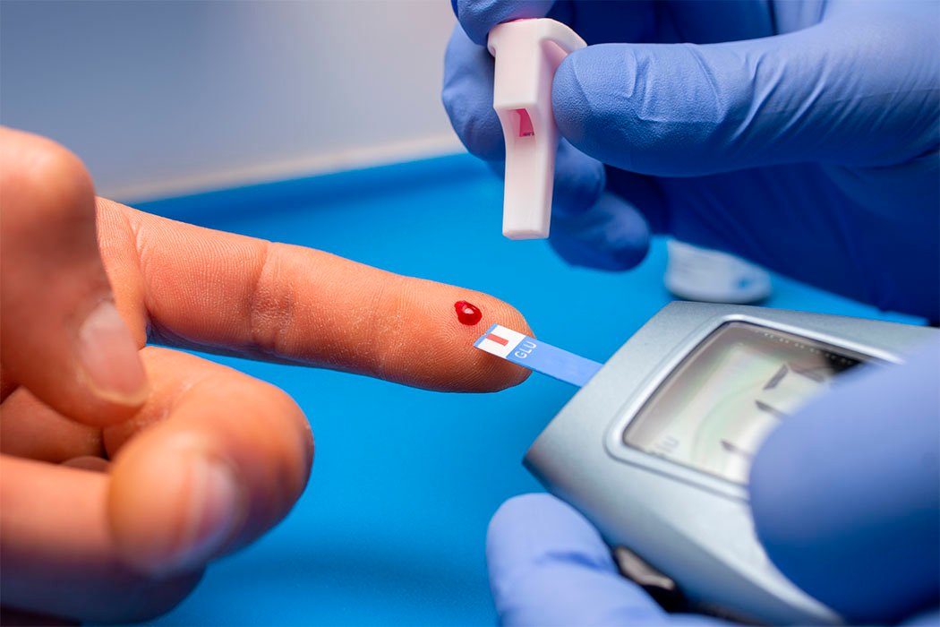 Prediabetes